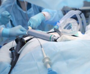 Gastric Suction During Anesthesia